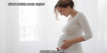 Siyah Lekeler Nasıl Geçer?