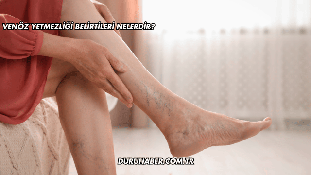 Venöz Yetmezliği Belirtileri Nelerdir?